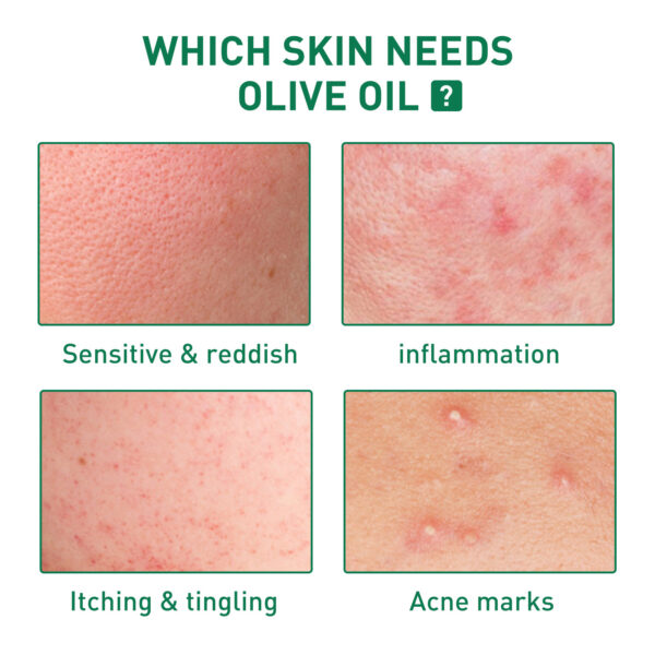 Tea Tree Oil Facial Skin Cleaning And Repair - Image 2